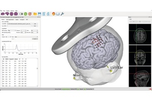 The principles and application of MRI-Guided Neuronavigation