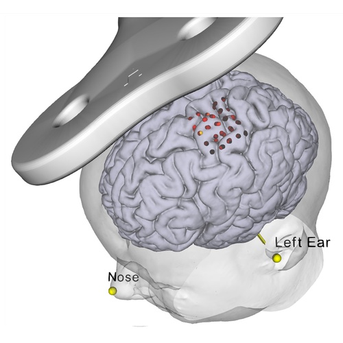 Neural Navigator MotorMap variant