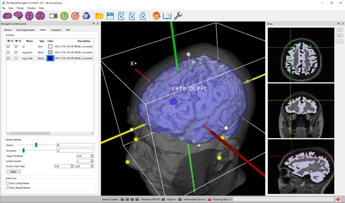 Neural Navigator Upgrade