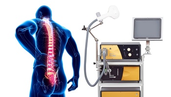 rTMS treatment of neuropathic pain