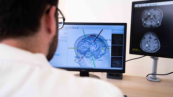 Planning van glioomresectie met MRI-geleide neuronavigatie voor TMS